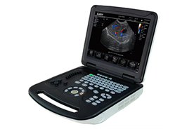 KR-E80手提筆記本式彩超機