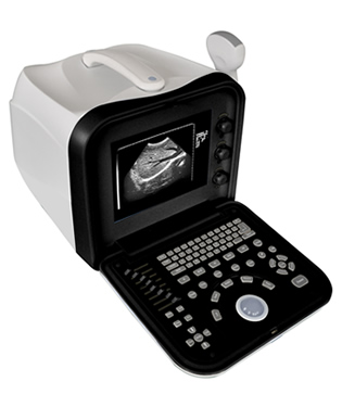 便攜式全數(shù)字B超
